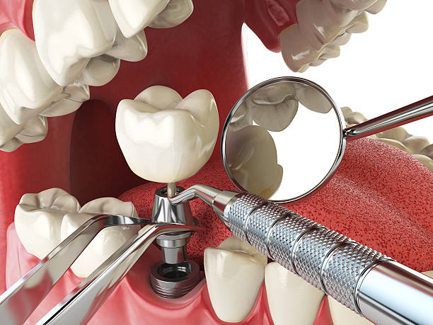 Best Emergency Treatment for Dental Infections or Abscesses in Garland, UT